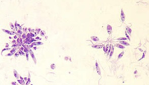 Cysticercosis - Anisakiasis - Leishmaniasis - Espundia