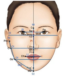 Oral-facial-digital (OFD) sendromları