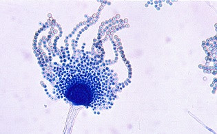 Aspergillozis - Aspergillus stomatiti 