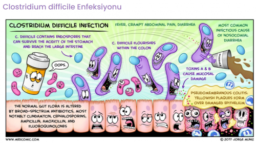 clostridium difficile enfeksiyonu